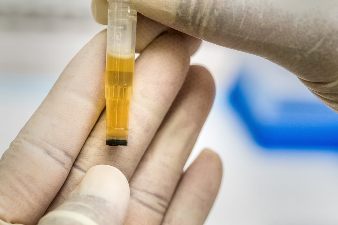 Advanced Lipid Panels: Particle Size and Density Testing Beyond Cholesterol person holding yellow and clear tube